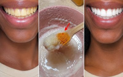 in two minutes remove 10 years of stains from teeth!! Results will Shock You