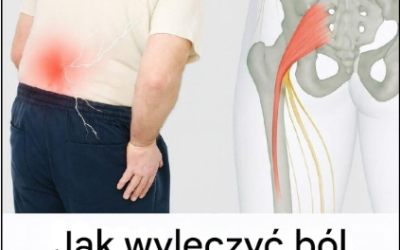 How to Treat Sciatic Nerve Pain: A Guide to Natural Remedies
