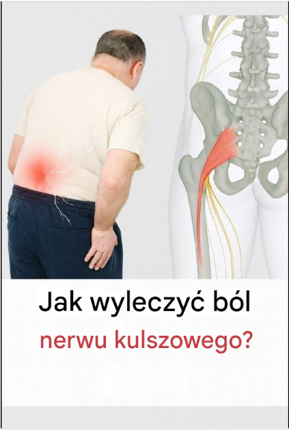 How to Treat Sciatic Nerve Pain: A Guide to Natural Remedies