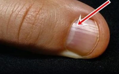 The Best Foods for Stronger Nails After 40