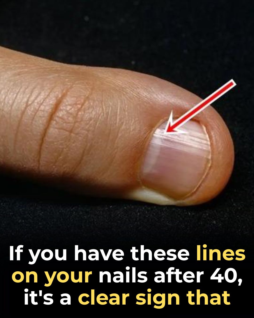 The Best Foods for Stronger Nails After 40