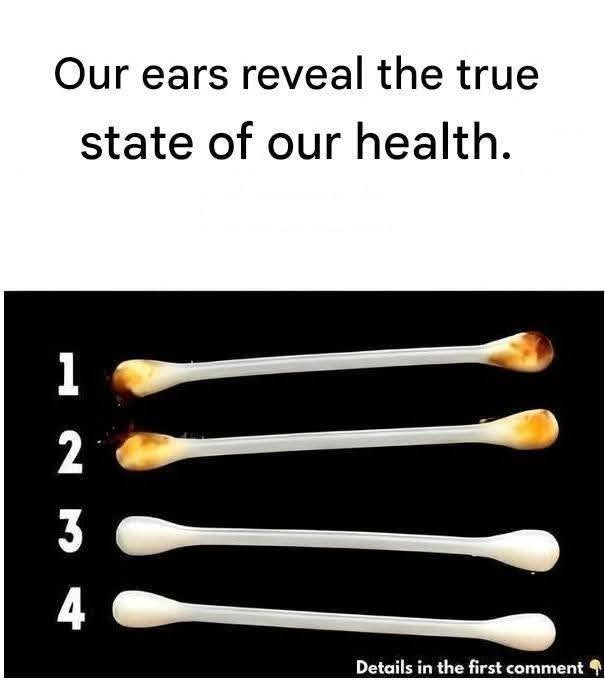 Our ears reveal the true state of our health