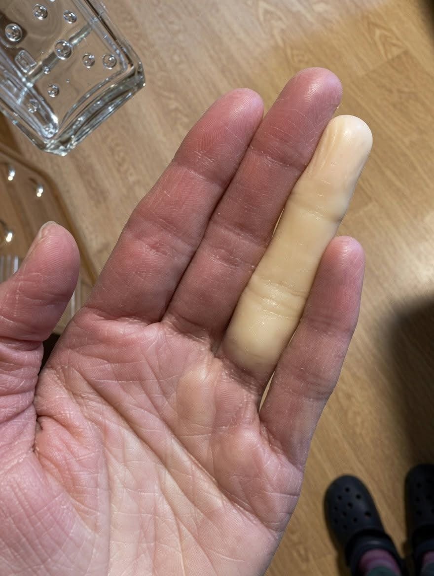 Ever woke up with a completely pale, numb finger?