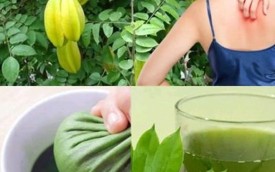 Star Fruit Leaves Exposed: The Astonishing Remedies for Health and Hives Relief You’ve Been Overlooking