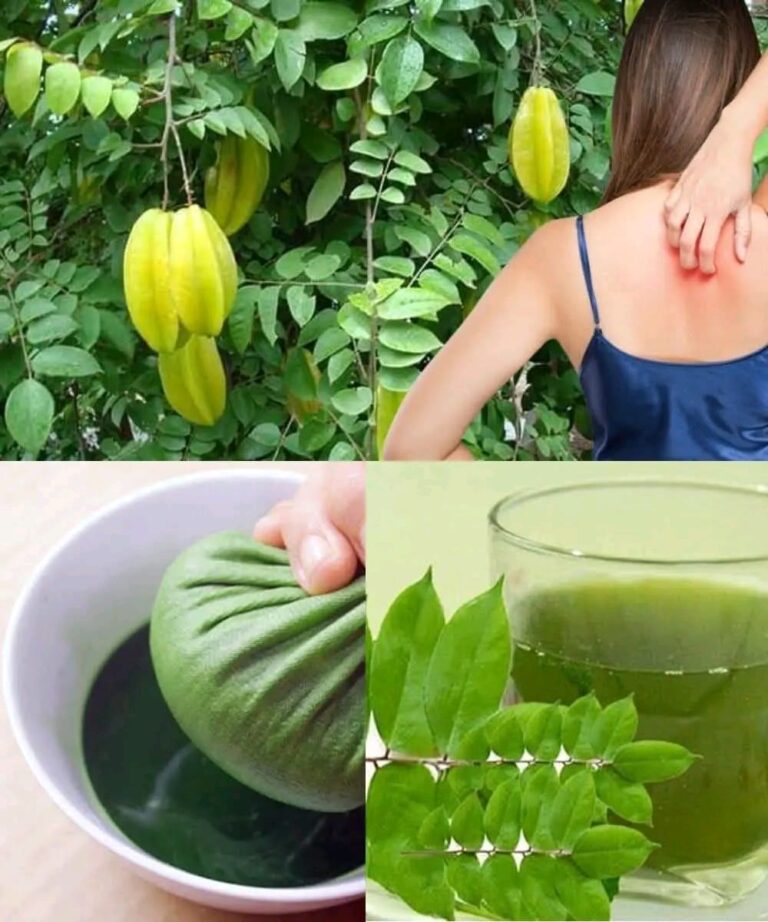 Star Fruit Leaves Exposed: The Astonishing Remedies for Health and Hives Relief You’ve Been Overlooking