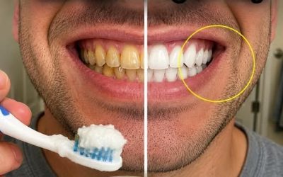 This Simple At-Home Routine Is Getting Attention for Naturally Brighter-Looking Teeth in People Over 60
