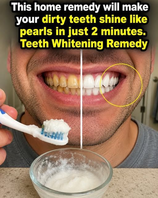 This Simple At-Home Routine Is Getting Attention for Naturally Brighter-Looking Teeth in People Over 60
