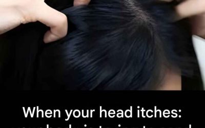 Itchy head? Here are the main causesItchy head? Here are the main causes
